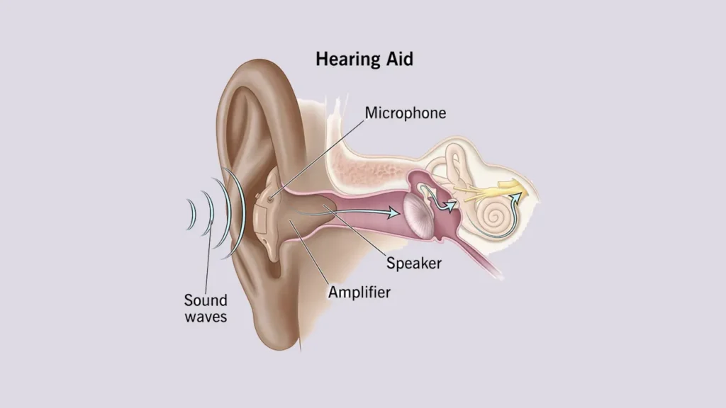 تقویت صدا از طریق سمعک