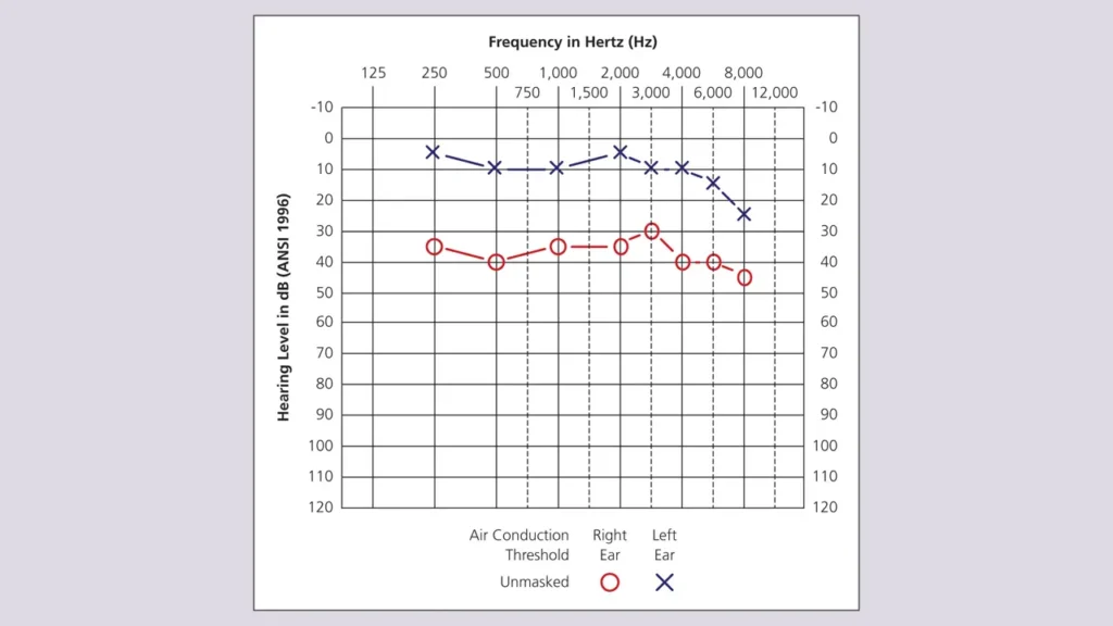 نمونه تست شنوایی سنجی