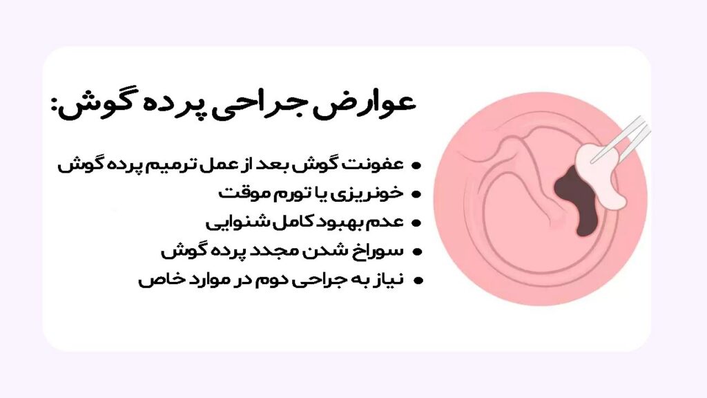 عوارض تمپانوپلاستی