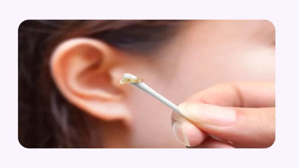 جرم گوش چیست