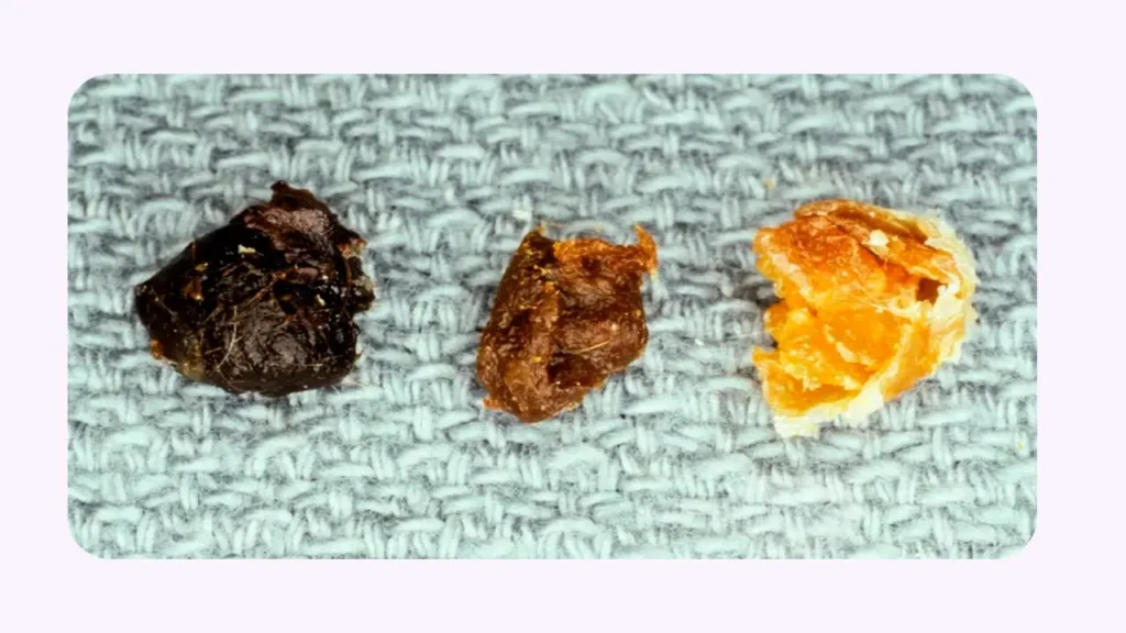 انواع جرم گوش