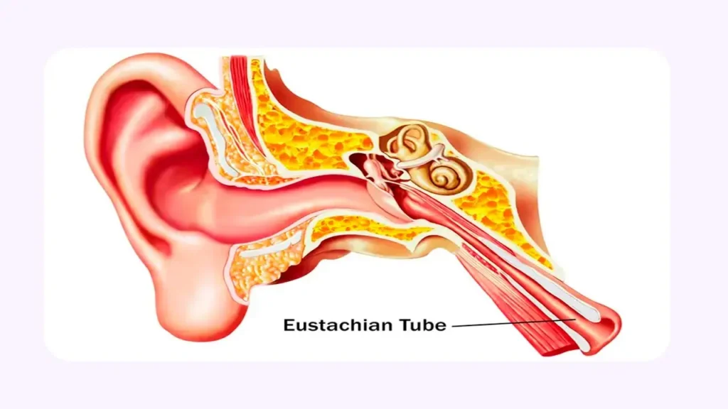 انسداد شیپور استاش