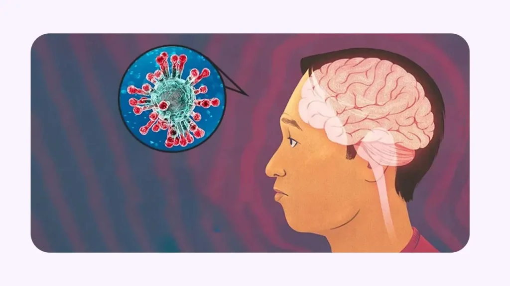 عفونت های مغزی سبب آفازی خواهد شد .