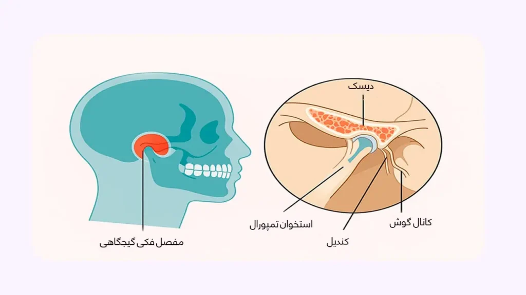 مفصل گیجگاهی فکی (TMJ) چیست