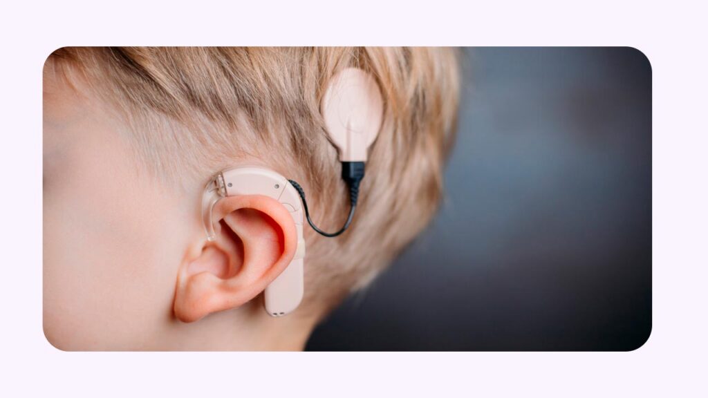 کاشت حلزون برای کودکان مبتلا به کم شنوایی ارثی 