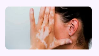 ارتباط بین پیسی و کم شنوایی؛ آیا بیماری پیسی می تواند بر شنوایی تاثیر بگذارد؟