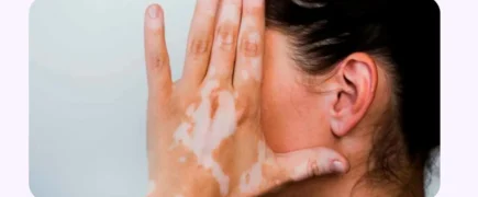 ارتباط بین پیسی و کم شنوایی؛ آیا بیماری پیسی می تواند بر شنوایی تاثیر بگذارد؟