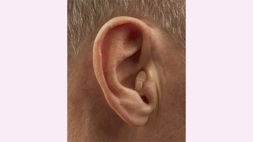 عکس سمعک داخل گوش