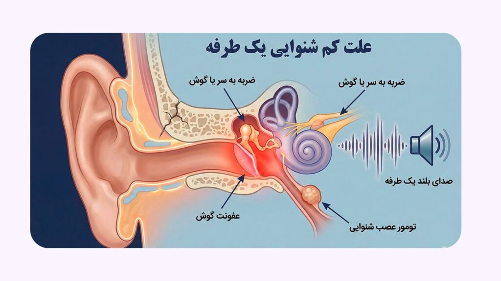 علت کم شنوایی یک طرفه