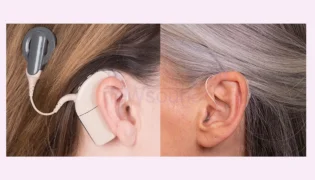 کاشت حلزون یا سمعک؟ شاخص