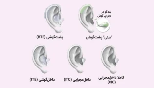مزایا و معایب انواع سمعک شاخص
