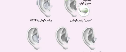 مزایا و معایب انواع سمعک شاخص