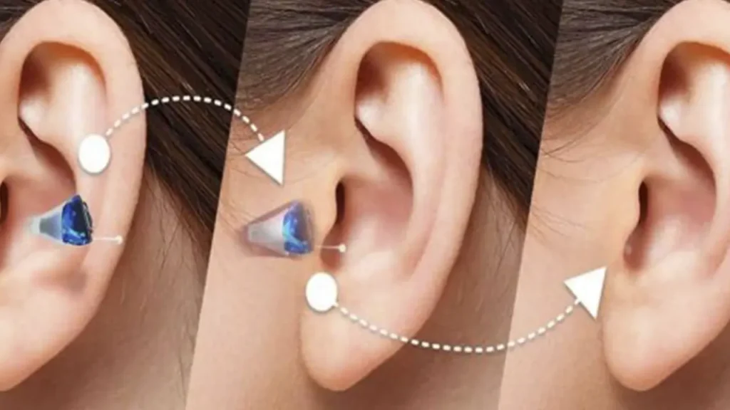 بهترین برند سمعک داخل گوشی کدام است شاخص