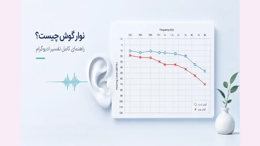 نوار گوش