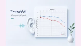 نوار گوش