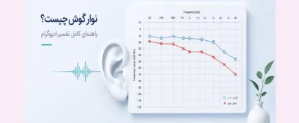 نوار گوش