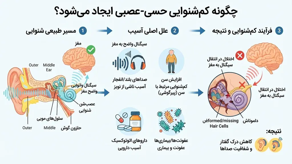 تصویر اینفوگرافیک از نحوه ایجاد کم شنوایی حسی عصبی