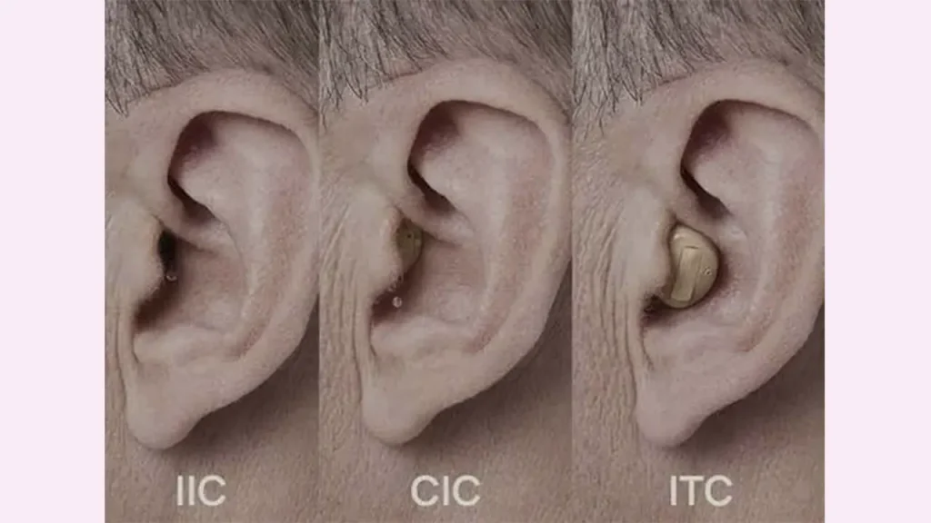 تفاوت قیمت IIC و CIC