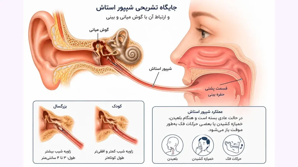 تصویر اینفوگرافیک از شیپور استاش