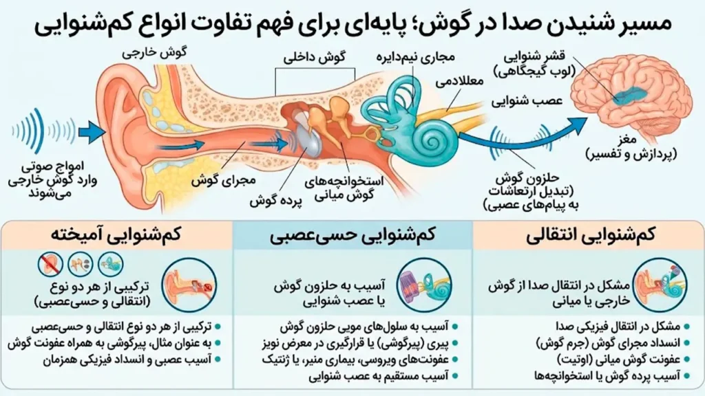 تصور شماتیک از مسیر شنیدن صدا در گوش