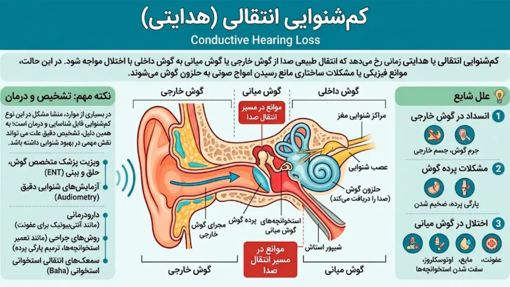 تصویر اینفوگرافیک از کم شنوایی انتقالی هدایتی